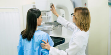 When Should You Start Getting Mammograms? A Guide by Age and Risk Level